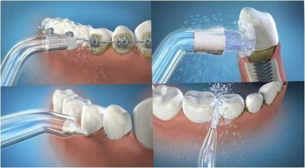 Spazzolamento con un irrigatore